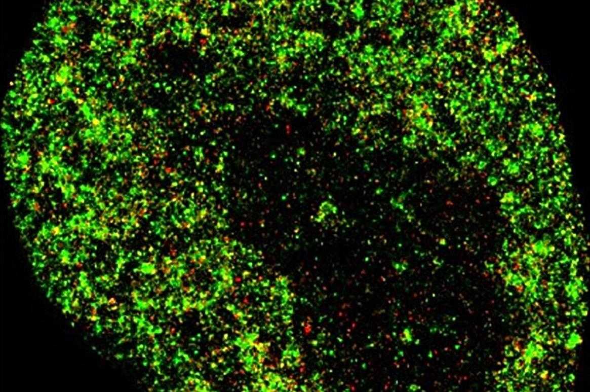 Nanoscale AI Revolutionizes Early Cancer and Viral Detection